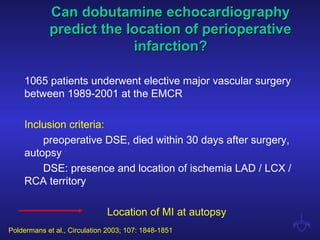 1065 patients underwent elective major vascular surgery
between 1989-2001 at the EMCR
Inclusion criteria:
preoperative DSE, died within 30 days after surgery,
autopsy
DSE: presence and location of ischemia LAD / LCX /
RCA territory
Location of MI at autopsy
Can dobutamine echocardiographyCan dobutamine echocardiography
predict the location of perioperativepredict the location of perioperative
infarction?infarction?
Poldermans et al., Circulation 2003; 107: 1848-1851
 