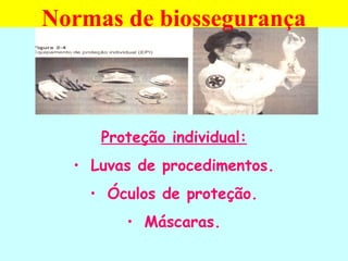 Proteção individual:
• Luvas de procedimentos.
• Óculos de proteção.
• Máscaras.
Normas de biossegurança
 
