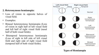 THE_PHYSIOLOGY_OF_VISION_(DR_EZE).pptx A comprehensive summery | PPTX