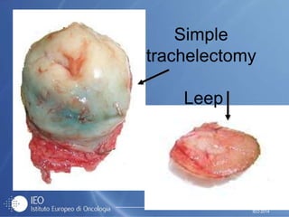 IEO 2014
Simple
trachelectomy
Leep
 