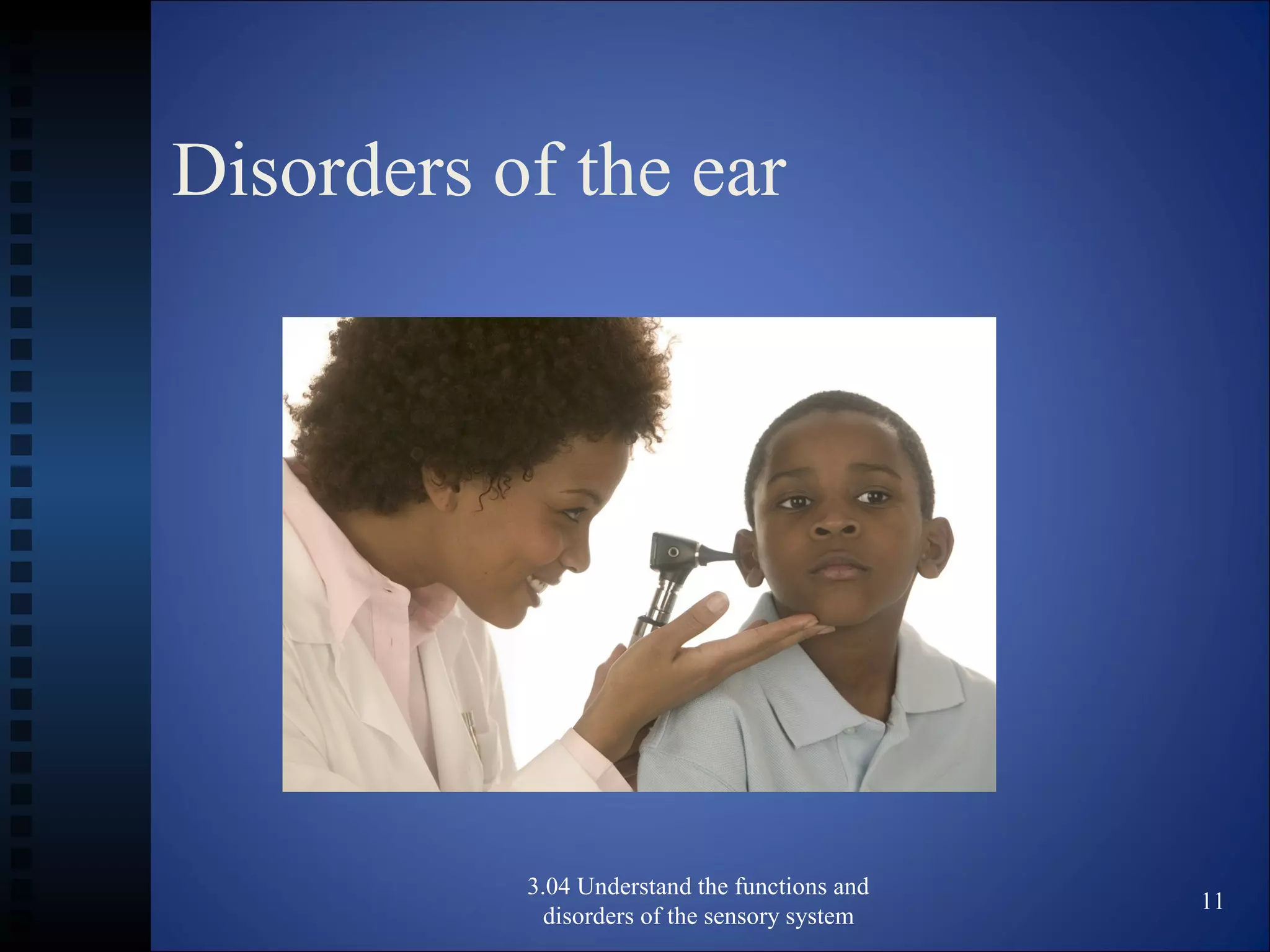 Disorders of the ear
3.04 Understand the functions and
disorders of the sensory system
11
 