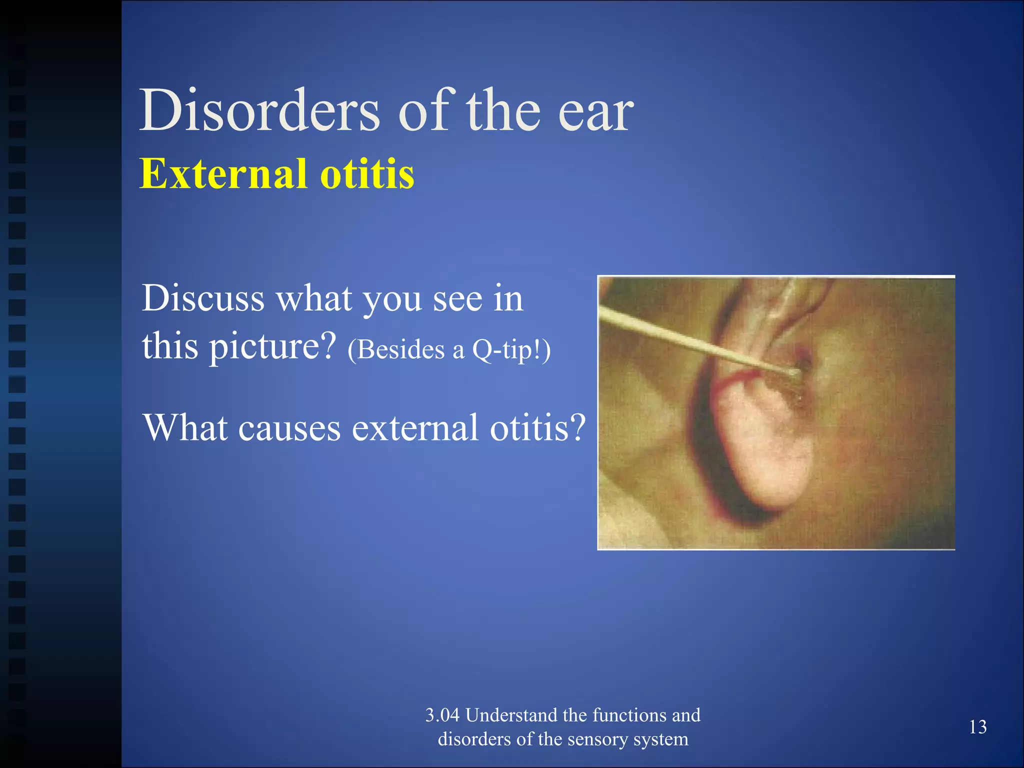 Disorders of the ear
External otitis
3.04 Understand the functions and
disorders of the sensory system
13
Discuss what you see in
this picture? (Besides a Q-tip!)
What causes external otitis?
 