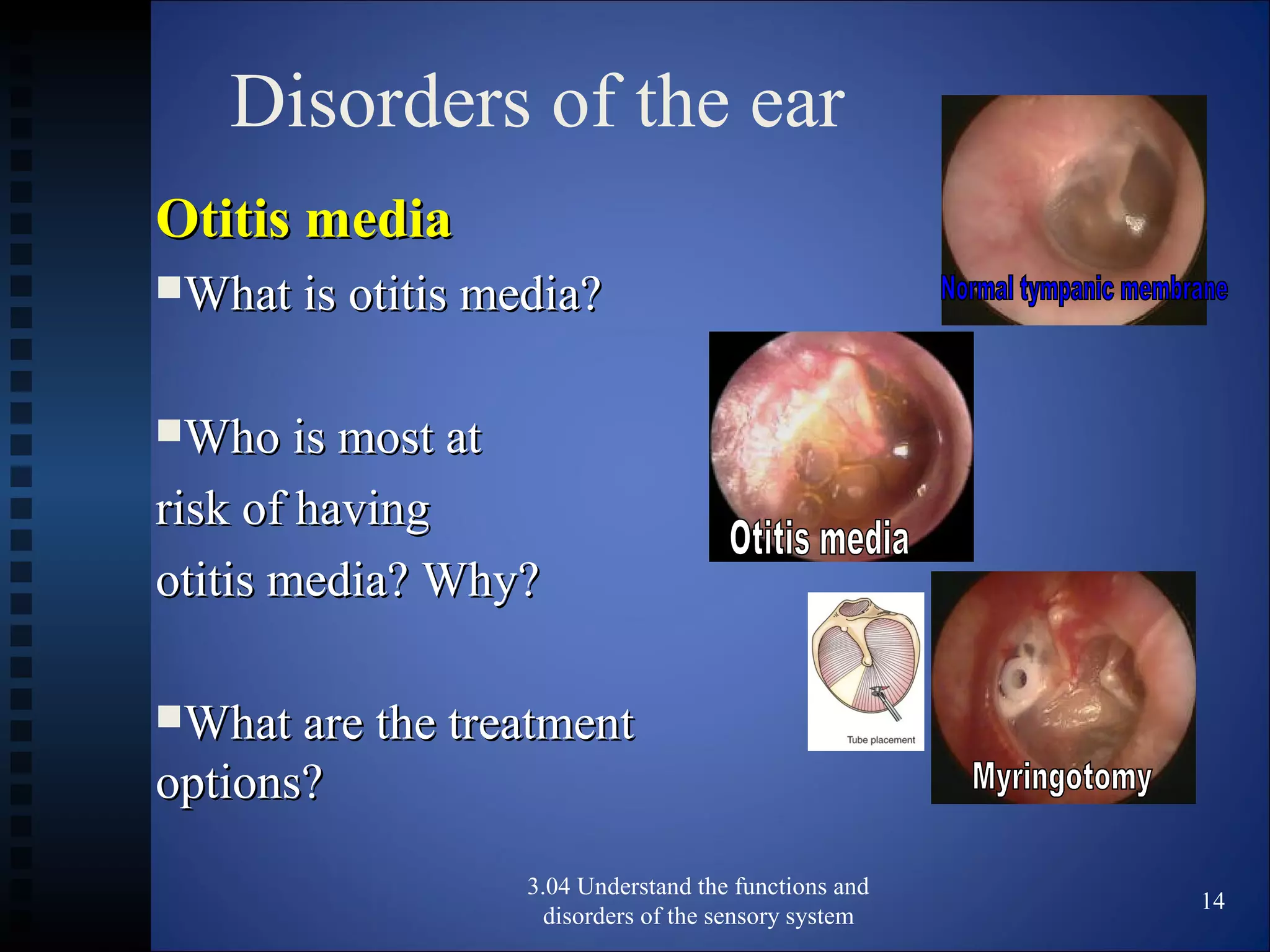 Disorders of the ear
Otitis mediaOtitis media
What is otitis media?What is otitis media?
Who is most atWho is most at
risk of havingrisk of having
otitis media? Why?otitis media? Why?
What are the treatmentWhat are the treatment
options?options?
3.04 Understand the functions and
disorders of the sensory system
14
 