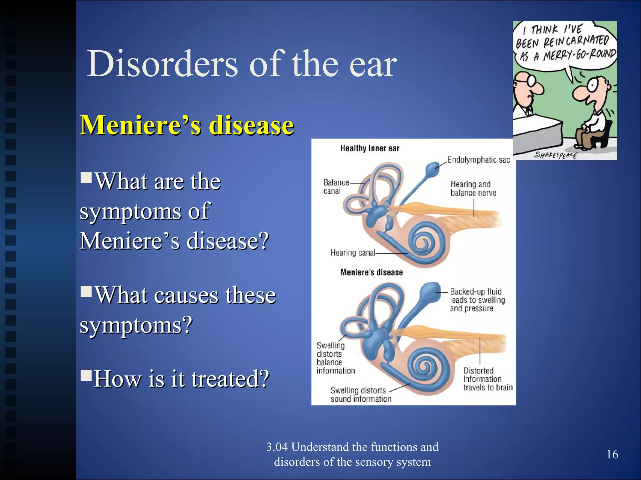 Disorders of the ear
Meniere’s diseaseMeniere’s disease
What are theWhat are the
symptoms ofsymptoms of
Meniere’s disease?Meniere’s disease?
What causes theseWhat causes these
symptoms?symptoms?
How is it treated?How is it treated?
3.04 Understand the functions and
disorders of the sensory system
16
 