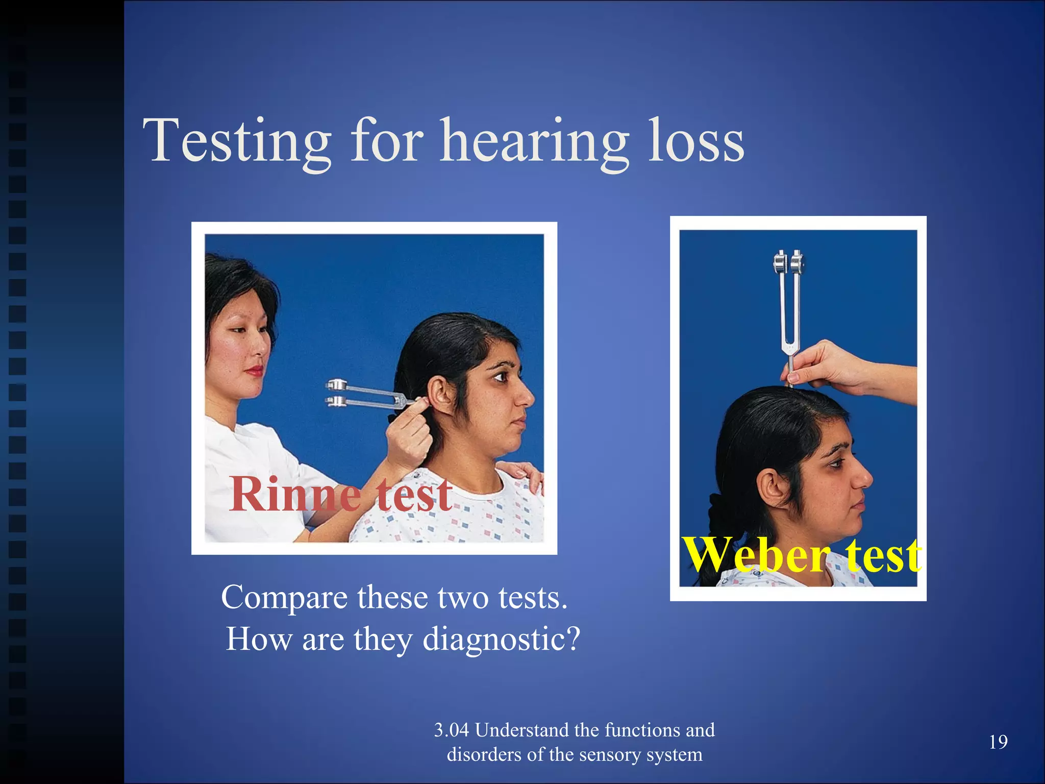 Testing for hearing loss
3.04 Understand the functions and
disorders of the sensory system
19
Weber test
Rinne test
Compare these two tests.
How are they diagnostic?
 