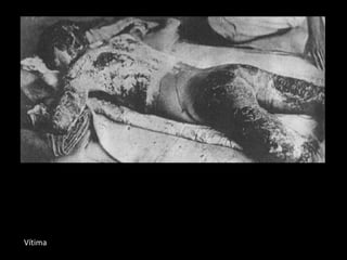 Vítima
 