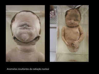 Anomalias resultantes da radiação nuclear
 
