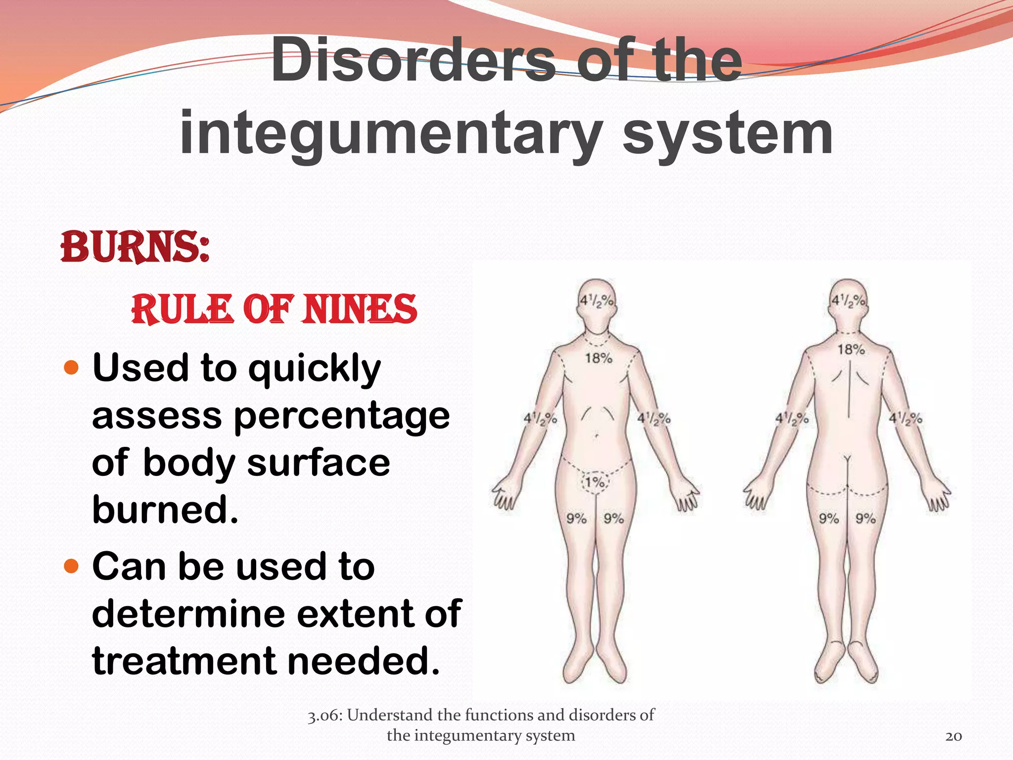 Disorders of the
integumentary system
Burns:
Rule of Nines
 Used to quickly
assess percentage
of body surface
burned.
 Can be used to
determine extent of
treatment needed.
3.06: Understand the functions and disorders of
the integumentary system 20
 