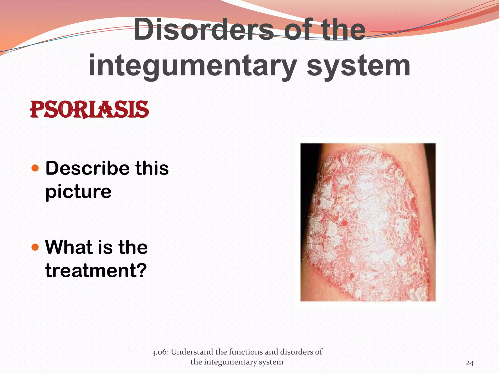 Disorders of the
integumentary system
Psoriasis
 Describe this
picture
 What is the
treatment?
3.06: Understand the functions and disorders of
the integumentary system 24
 