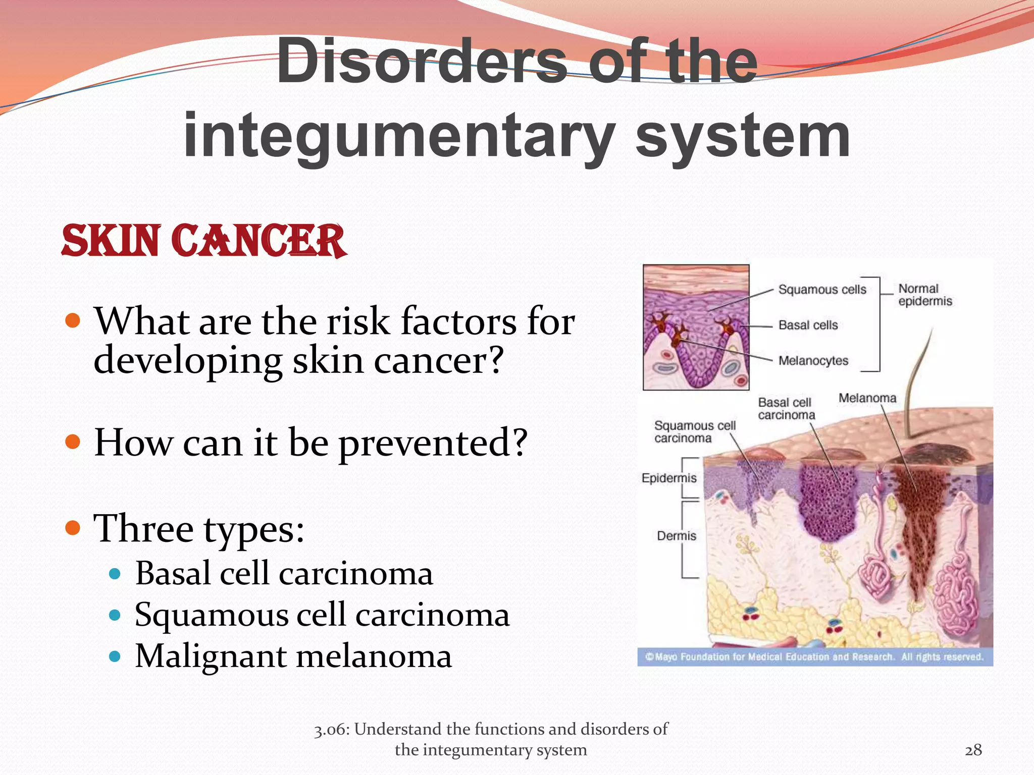 Disorders of the
integumentary system
Skin cancer
 What are the risk factors for
developing skin cancer?
 How can it be prevented?
 Three types:
 Basal cell carcinoma
 Squamous cell carcinoma
 Malignant melanoma
3.06: Understand the functions and disorders of
the integumentary system 28
 
