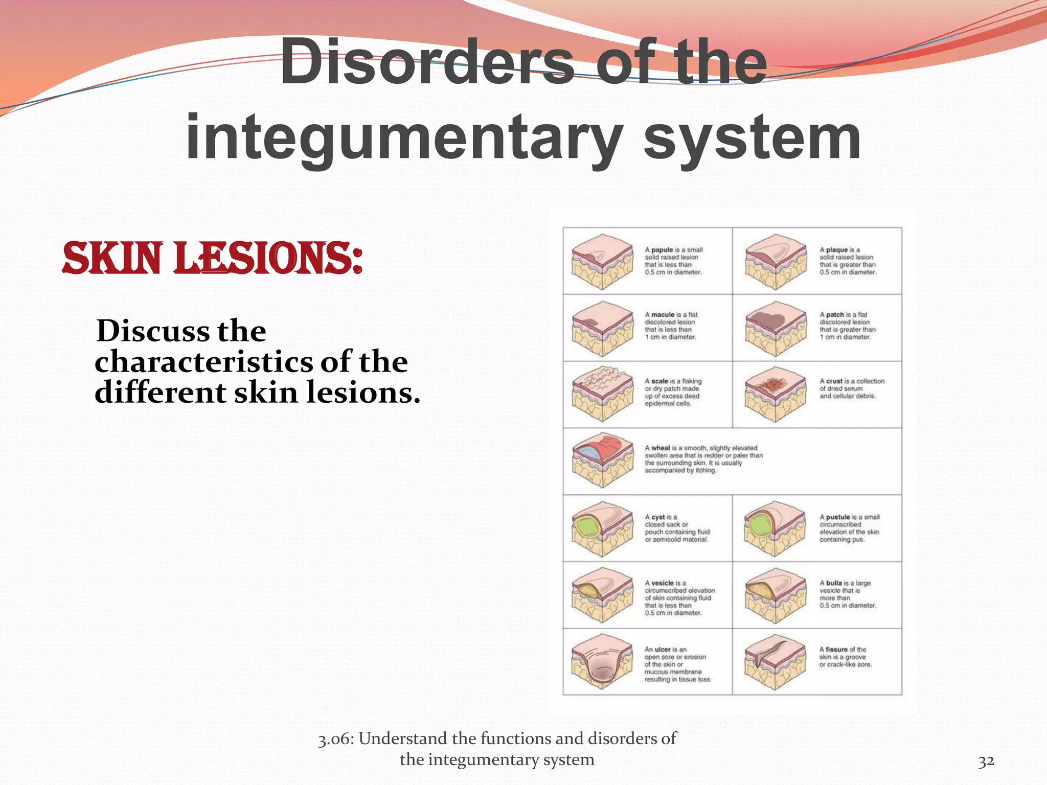 Disorders of the
integumentary system
Skin lesions:
Discuss the
characteristics of the
different skin lesions.
3.06: Understand the functions and disorders of
the integumentary system 32
 