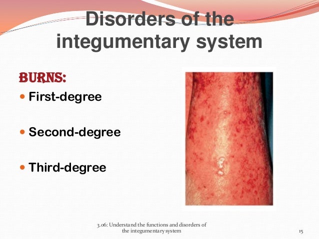 disease integumentary system Learn what the integumentary system is, how it works and what diseases and treatments suffer from this system is one the amazing systems of the human body. disease integumentary system Learn what the integumentary system is, how it works and what diseases and treatments suffer from this system is one the amazing systems of the human body.