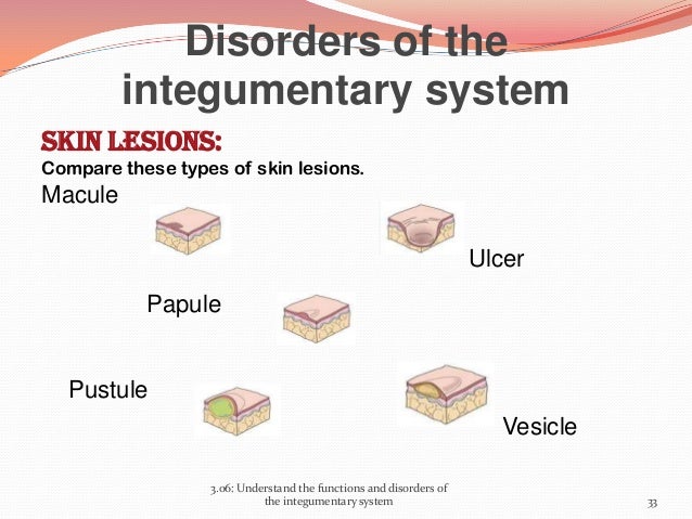 Functions and disorders of the Integumentary System