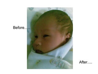 Before….. After…. 