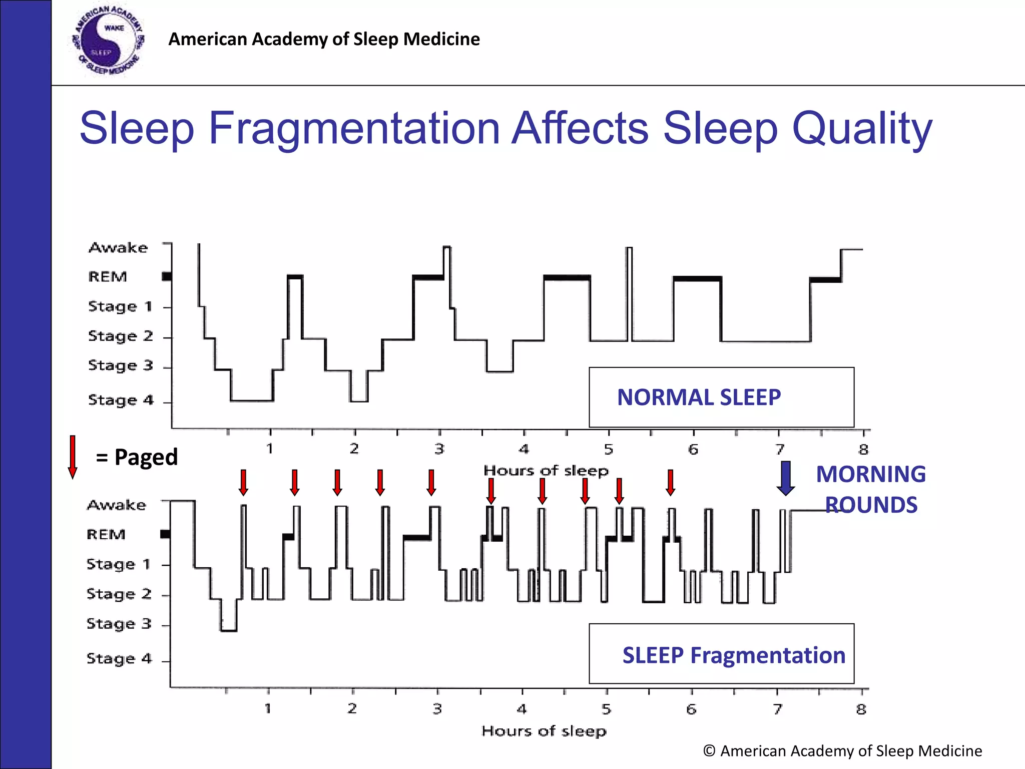 What Is Fragmented Sleep: Causes, Effects, and Solutions