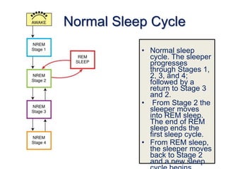 Normal Sleep Cycle
• Normal sleep
cycle. The sleeper
progresses
through Stages 1,
2, 3, and 4;
followed by a
return to Stage 3
and 2.
• From Stage 2 the
sleeper moves
into REM sleep.
The end of REM
sleep ends the
first sleep cycle.
• From REM sleep,
the sleeper moves
back to Stage 2
and a new sleep
 