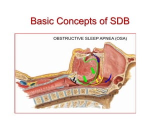 Basic Concepts of SDB
 