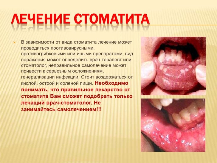 Слизистая рта нормальный цвет Слизистая рта нормальный цвет