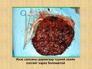 Ихэс салсаны дараагаар түүний эхийн
хэсгийг харах боломжтой
 