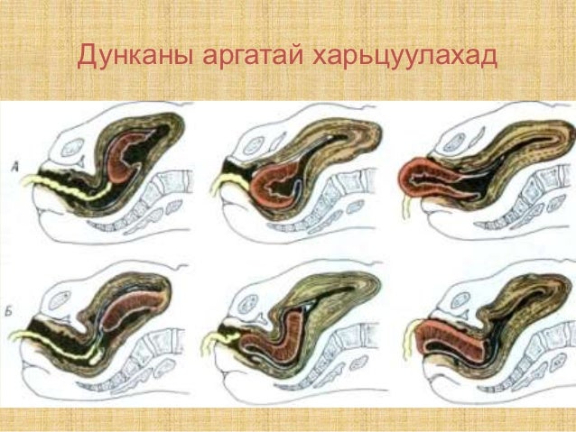 Как выглядит послед у собаки Чеплышка - CoffeePapa.ru