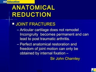 principles of fracture treatment | PPT