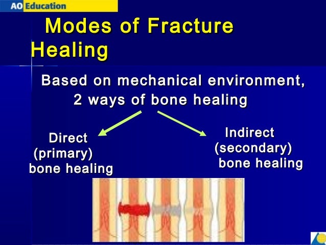 principles of fracture treatment
