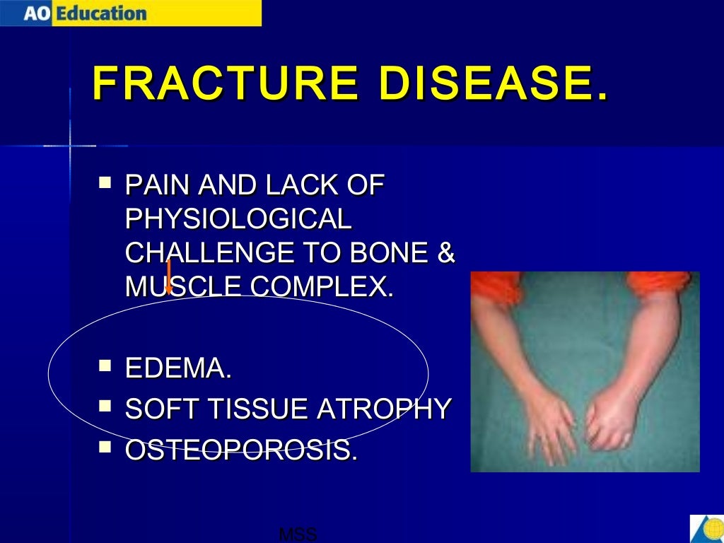 principles of fracture treatment