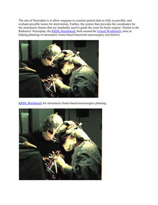 The aim of Stereoplan is to allow surgeons to examine patient data as fully as possible, and
evaluate possible routes for intervention. Further, the system then provides the coordinates for
the stereotactic frames that are standardly used to guide the route for brain surgery. Similar to the
Radionics' Stereoplan, the KRDL Brainbench, built around the Virtual Workbench, aims at
helping planning of stereotactic frame-based functional neurosurgery (see below).
KRDL Brainbench for stereotactic frame-based neurosurgery planning
 