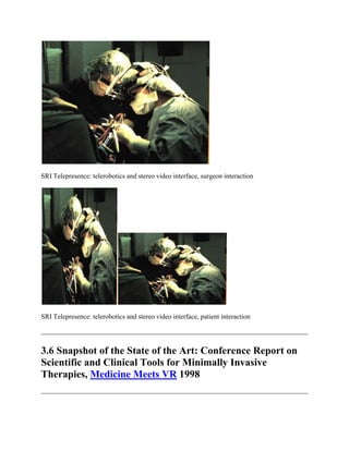 SRI Telepresence: telerobotics and stereo video interface, surgeon interaction
SRI Telepresence: telerobotics and stereo video interface, patient interaction
3.6 Snapshot of the State of the Art: Conference Report on
Scientific and Clinical Tools for Minimally Invasive
Therapies, Medicine Meets VR 1998
 