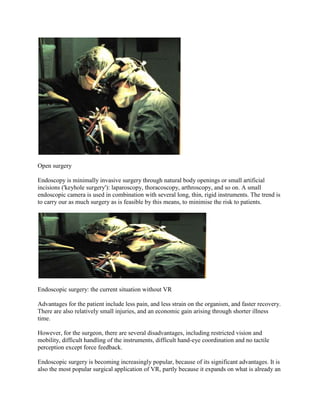 Open surgery
Endoscopy is minimally invasive surgery through natural body openings or small artificial
incisions ('keyhole surgery'): laparoscopy, thoracoscopy, arthroscopy, and so on. A small
endoscopic camera is used in combination with several long, thin, rigid instruments. The trend is
to carry our as much surgery as is feasible by this means, to minimise the risk to patients.
Endoscopic surgery: the current situation without VR
Advantages for the patient include less pain, and less strain on the organism, and faster recovery.
There are also relatively small injuries, and an economic gain arising through shorter illness
time.
However, for the surgeon, there are several disadvantages, including restricted vision and
mobility, difficult handling of the instruments, difficult hand-eye coordination and no tactile
perception except force feedback.
Endoscopic surgery is becoming increasingly popular, because of its significant advantages. It is
also the most popular surgical application of VR, partly because it expands on what is already an
 