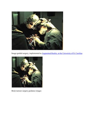 Image-guided surgery, implemented as Augmented Reality, at the University of N. Carolina
Brain tumour surgery guidance images
 