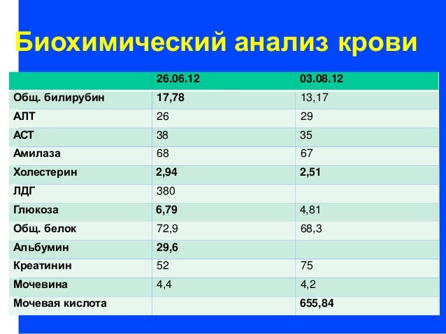 Анализ в машине