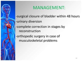 congenital anomalies of renal system | PPSX