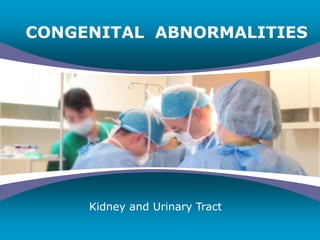Company
LOGO
CONGENITAL ABNORMALITIES
Kidney and Urinary Tract
 