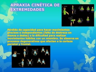Pérdida de capacidad para hacer movimientos
precisos e independientes (falta de destreza en
manos o dedos) o la dificultad para realizar
movimientos hábiles con un miembro. Se observa en
procesos degenerativos que afectan a la corteza
parietal y frontal.
 