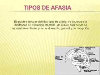 Es posible señalar distintos tipos de afasia, de acuerdo a la
modalidad de expresión afectada, las cuales casi nunca se
encuentran en forma pura: oral, escrita, gestual y de recepción.
 
