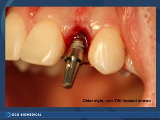Older style, non-TiNi implant shown