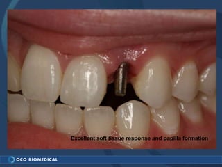 Excellent soft tissue response and papilla formation