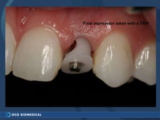 Final impression taken with a TRIP