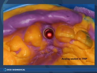 Analog seated in TRIP