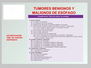 TUMORES BENIGNOS Y
MALIGNOS DE ESÓFAGO

ESTADIFICACIÓN
TNM Del CANCER
ESOFÁGICO

 