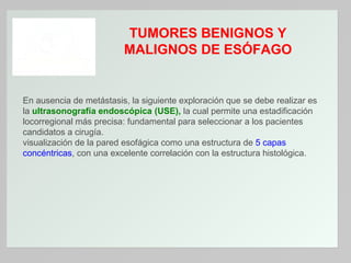 TUMORES BENIGNOS Y
MALIGNOS DE ESÓFAGO

En ausencia de metástasis, la siguiente exploración que se debe realizar es
la ultrasonografía endoscópica (USE), la cual permite una estadificación
locorregional más precisa: fundamental para seleccionar a los pacientes
candidatos a cirugía.
visualización de la pared esofágica como una estructura de 5 capas
concéntricas, con una excelente correlación con la estructura histológica.

 