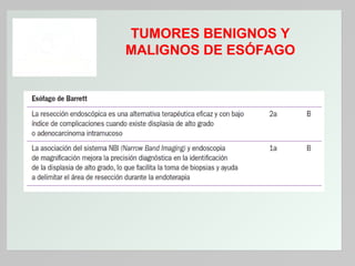TUMORES BENIGNOS Y
MALIGNOS DE ESÓFAGO

 