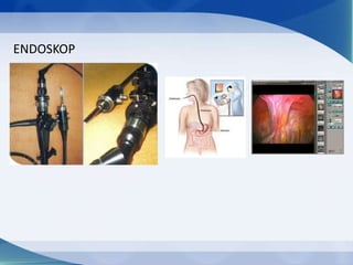ENDOSKOP

 
