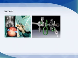 SISTOKOP

 