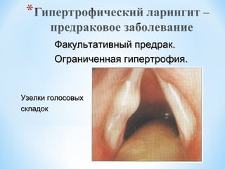 Факультативный предрак.
Ограниченная гипертрофия.

Узелки голосовых
складок

 