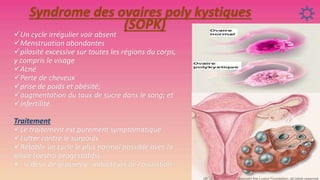 Syndrome des ovaires poly kystiques
(SOPK)

Un cycle irrégulier voir absent
Menstruation abondantes
pilosité excessive sur toutes les régions du corps,
y compris le visage
Acné
Perte de cheveux
prise de poids et obésité;
augmentation du taux de sucre dans le sang; et
infertilité.
Traitement
Le traitement est purement symptomatique
Lutter contre le surpoids
Rétablir un cycle le plus normal possible avec la
pilule (oestro-progestatifs)
 si désir de grossesse: inducteurs de l’ovulation .

 