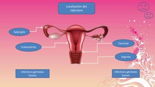 Localisation des
infections

Salpingite

Cervicite
Endométrite
Vaginite

Infections génitales
hautes

Infections génitales
basses

 