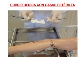 CUBRIR HERIDA CON GASAS ESTÉRILES
 
