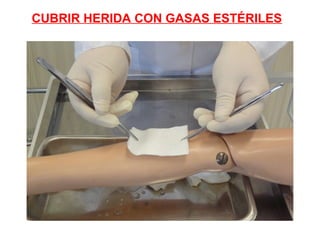 CUBRIR HERIDA CON GASAS ESTÉRILES
 